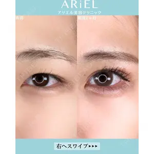 アリエル美容クリニック 大宮院 鈴木　桂介医師の症例