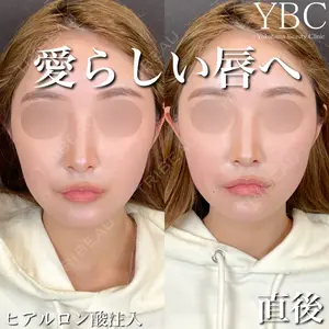 YBC横浜美容外科 大宮院 磯村 亮輔医師の症例