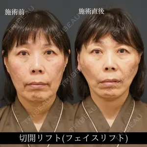 RIVER CLINIC（リバークリニック） 山本　有祐医師の症例