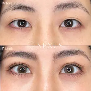 NEXUS CLINIC 横田 智子医師の症例