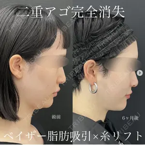 湘南美容クリニック 名古屋駅本院 豊嶋 沙良医師の症例