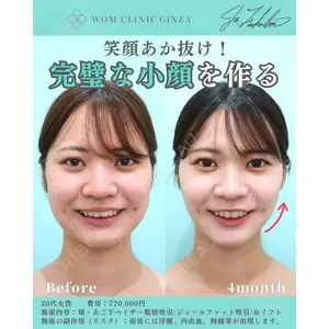 WOM CLINIC GINZA （ワム クリニック ギンザ） 深堀 純也医師の症例