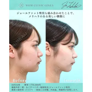 WOM CLINIC GINZA （ワム クリニック ギンザ） 深堀 純也医師の症例