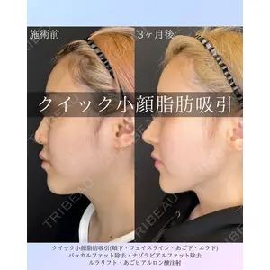 ルラ美容クリニック 札幌院 佐藤 雄紀医師の症例