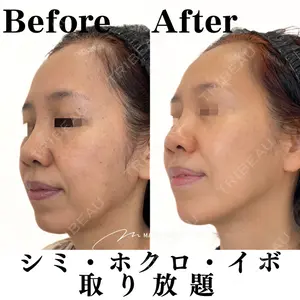 Mavie Beauty Clinic （マヴィービューティークリニック）の症例