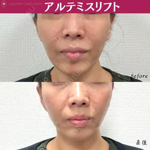 ギャラリークリニック 銀座の症例
