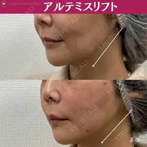 ギャラリークリニック 銀座の症例