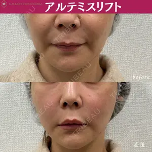 ギャラリークリニック 銀座の症例