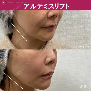 ギャラリークリニック 銀座の症例