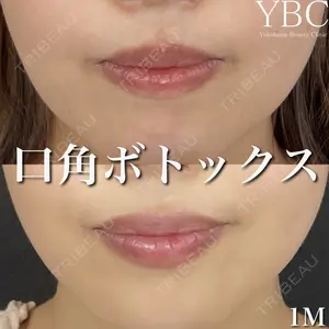 YBC横浜美容外科 大宮院 磯村 亮輔医師の症例