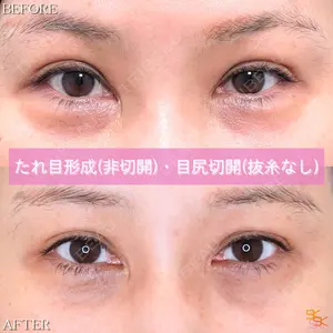 SK新宿歌舞伎町美容外科・歯科の症例