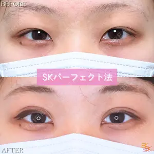 SK新宿歌舞伎町美容外科・歯科の症例
