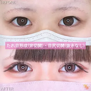 SK新宿歌舞伎町美容外科・歯科の症例