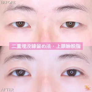 SK新宿歌舞伎町美容外科・歯科の症例