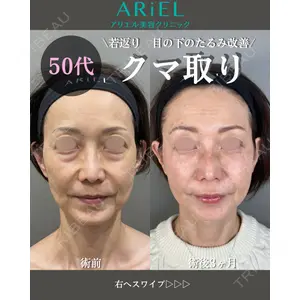 アリエル美容クリニック 大宮院 鈴木　桂介医師の症例