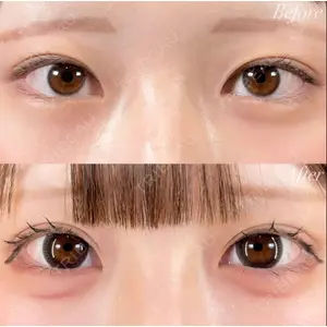 R Beauty CLINIC 銀座院 富田 莉沙子医師の症例