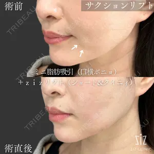 ziz CLINIC 村岡 史子医師の症例