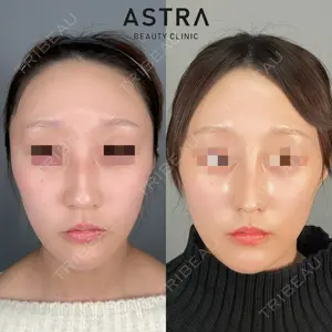 ASTRA BEAUTY CLINIC 塩満 惠子医師の症例