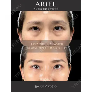 アリエル美容クリニック 大宮院 鈴木　桂介医師の症例