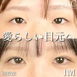 YBC横浜美容外科 大宮院 磯村 亮輔医師の症例