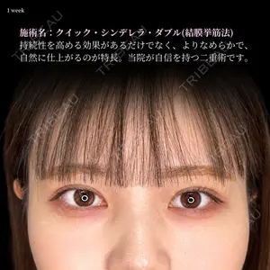 東京シンデレラ美容外科 大宮院 竹田 昌平医師の症例