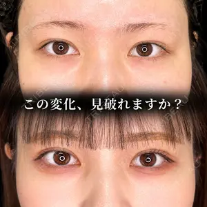 東京シンデレラ美容外科 大宮院 竹田 昌平医師の症例