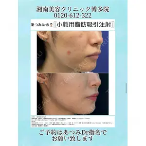 湘南美容クリニック 博多院 渥美 智晶医師の症例