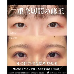 シンデレラ＆ダヴィンチクリニック 宮田 洋佑医師の症例