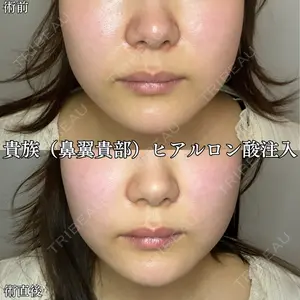 形成外科と美容外科のクリニック池袋 春日 航医師の症例