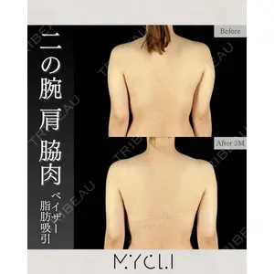 MYCLI【マイクリ】 本田マイケル武史医師の症例