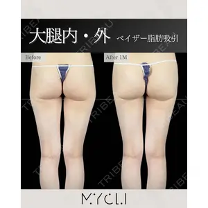 MYCLI【マイクリ】 本田マイケル武史医師の症例