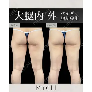 MYCLI【マイクリ】 本田マイケル武史医師の症例