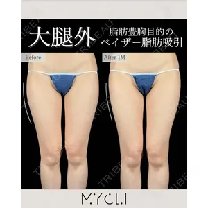 MYCLI【マイクリ】 本田マイケル武史医師の症例