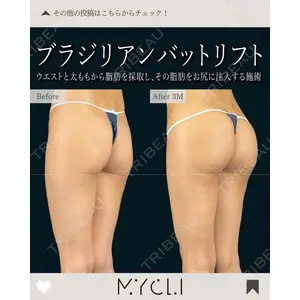 MYCLI【マイクリ】 本田マイケル武史医師の症例