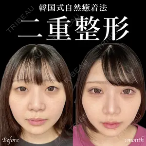 東京シンデレラ美容外科 新宿院 土門 一迅医師の症例