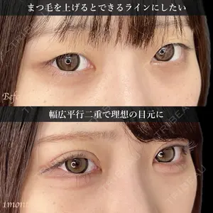 東京シンデレラ美容外科 新宿院 土門 一迅医師の症例