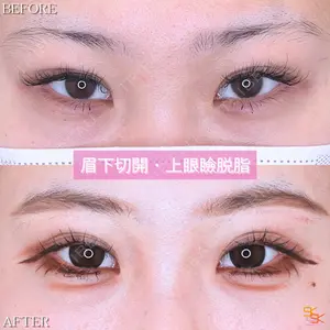 SK新宿歌舞伎町美容外科・歯科の症例