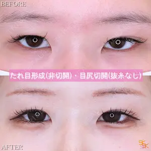 SK新宿歌舞伎町美容外科・歯科の症例