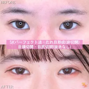 SK新宿歌舞伎町美容外科・歯科の症例