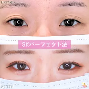 SK新宿歌舞伎町美容外科・歯科の症例