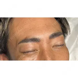 脱毛クリニック麒麟の症例