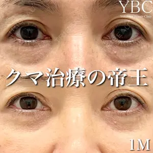 YBC横浜美容外科 大宮院 磯村 亮輔医師の症例