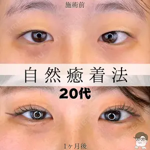 ルラ美容クリニック 札幌院 佐藤 雄紀医師の症例