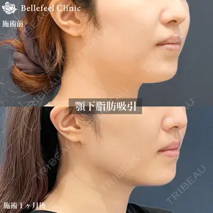 Bellefeel Clinic 新宿 中務 秀一医師の症例