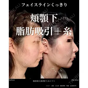 グローバルビューティークリニック 大阪院の症例