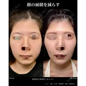 グローバルビューティークリニック 大阪院の症例