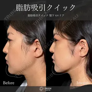 PRISM Beauty Clinic 畑山 知輝医師の症例