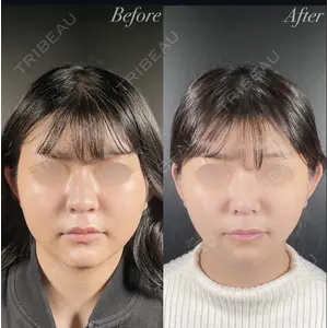 R Beauty CLINIC 銀座院 中西 友莉医師の症例