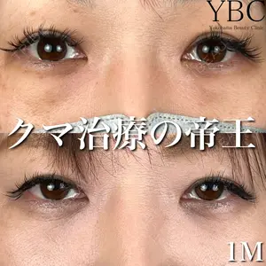 YBC横浜美容外科 大宮院 磯村 亮輔医師の症例