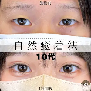 ルラ美容クリニック 札幌院 佐藤 雄紀医師の症例